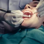 Comprehensive Guide to Single Tooth Implant Cost Without Insurance